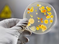 Организация и проведение дезинфекционных мероприятий при  энтеровирусных (неполио) инфекциях
